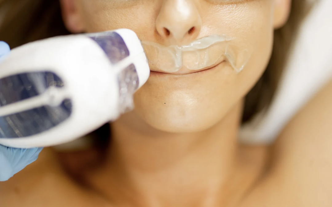 Advanced Laser Hair Removal Treatments Near Kensington, Maryland